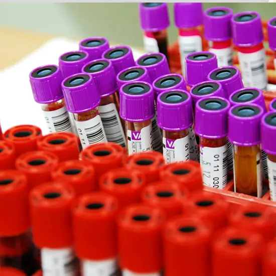 c4 complement component test